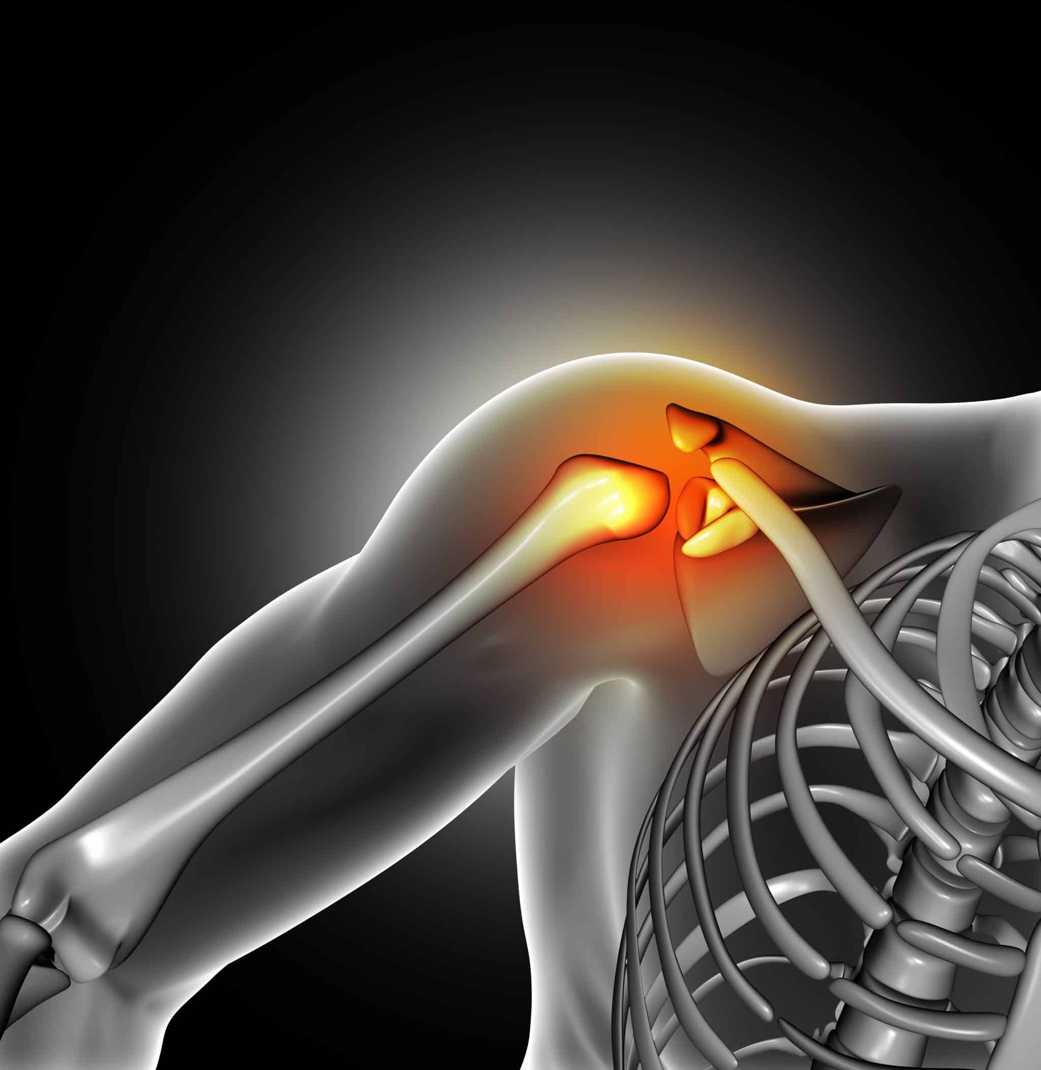 pain shoulder joint