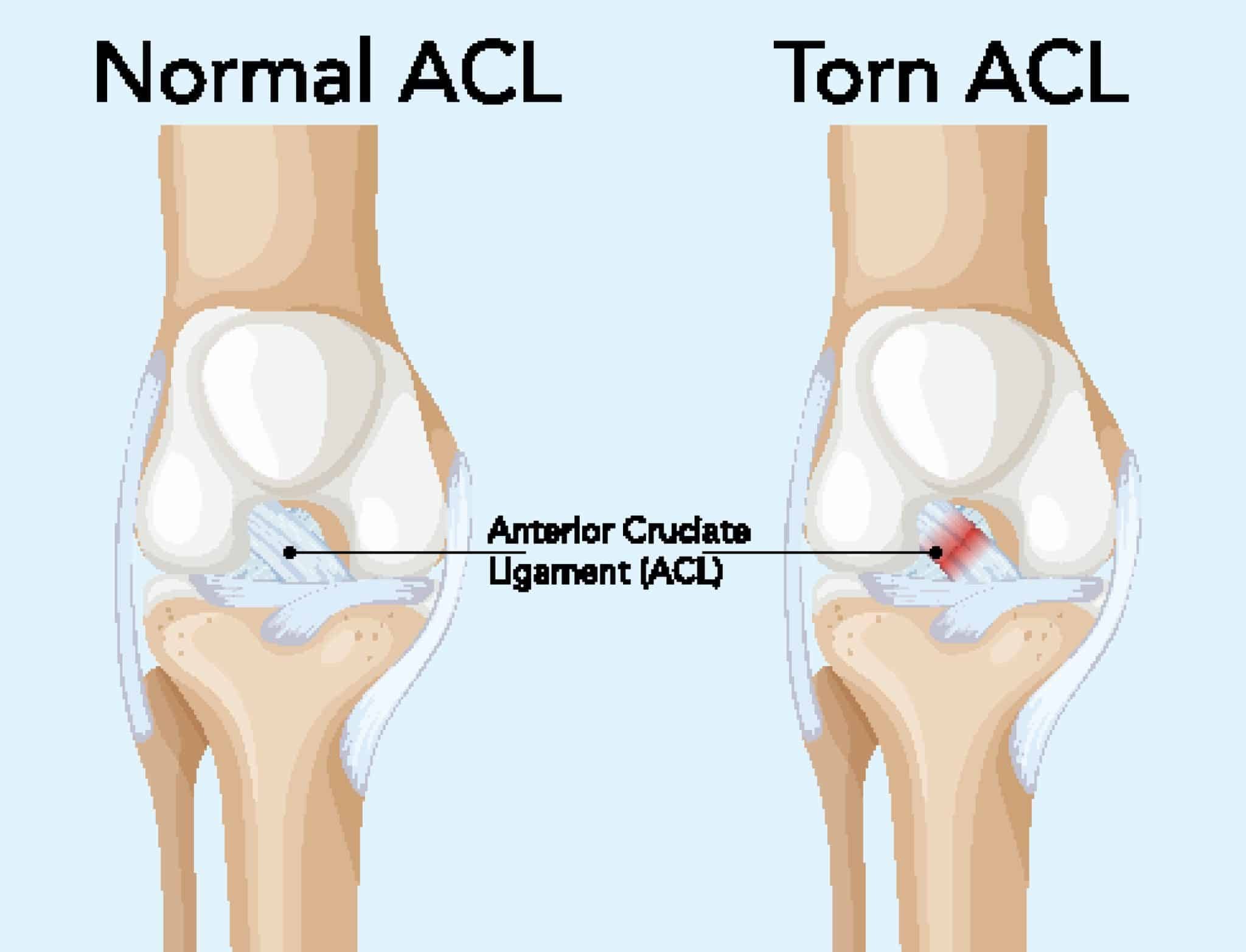 AdobeStock 1441807846 scaled